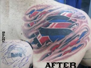 Superman Logo unter der Haut